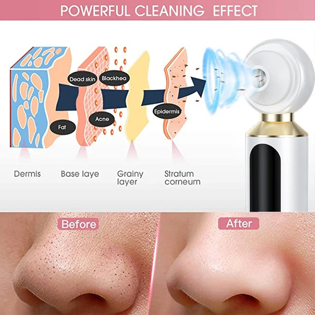 Visual Blackhead Suction Instrument Blackhead Remover Vacuum Pore Cleaner With Camera